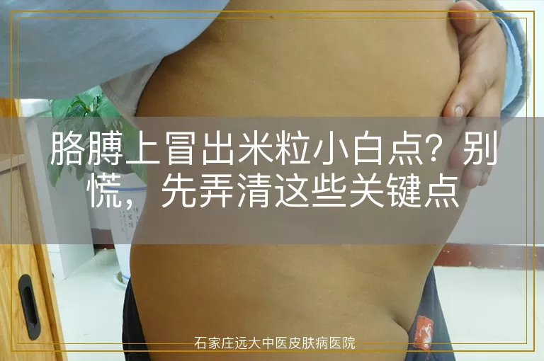胳膊上冒出米粒小白点？别慌，先弄清这些关键点