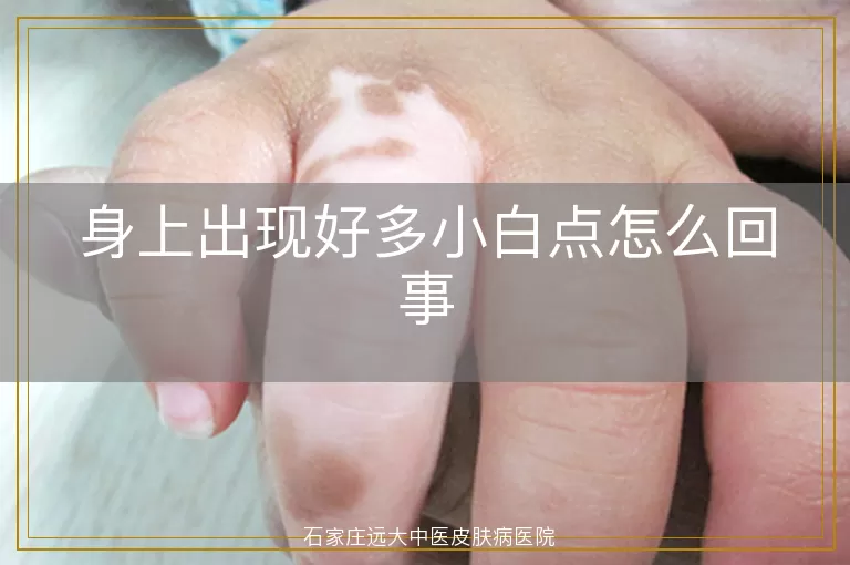身上出现好多小白点怎么回事