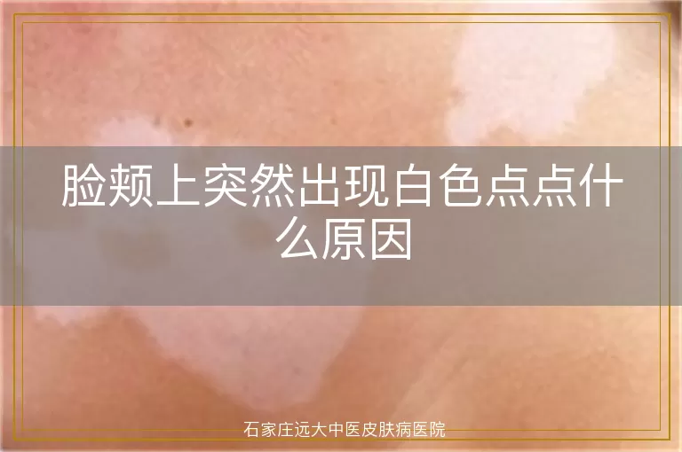 脸颊上突然出现白色点点什么原因