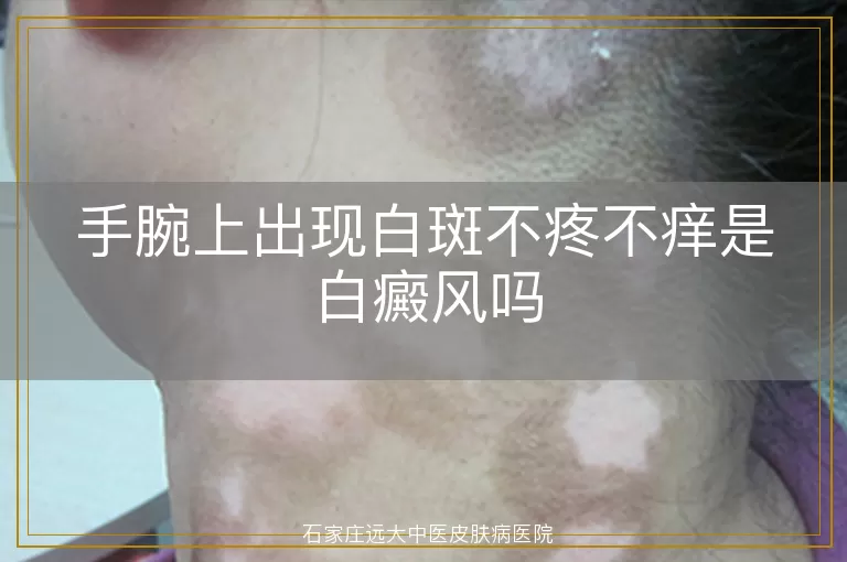 手腕上出现白斑不疼不痒是白癜风吗