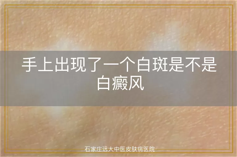 手上出现了一个白斑是不是白癜风