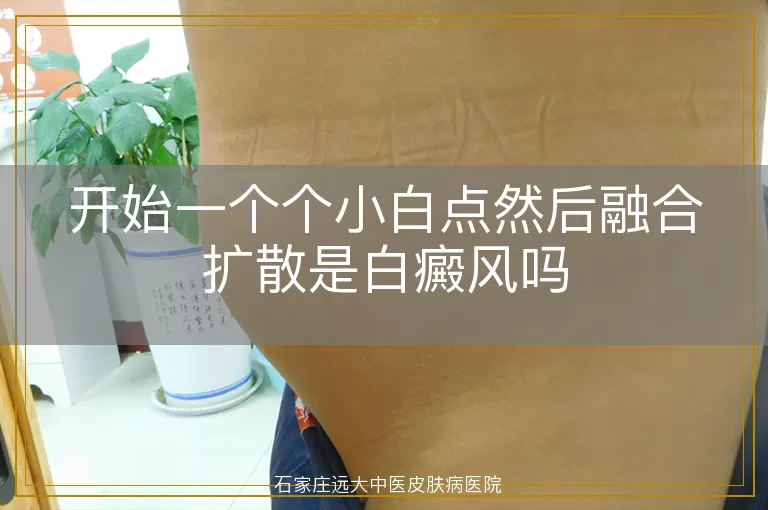 开始一个个小白点然后融合扩散是白癜风吗