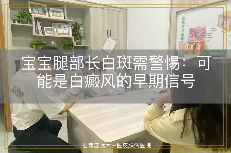宝宝腿部长白斑需警惕:可能是白癜风的早期信号