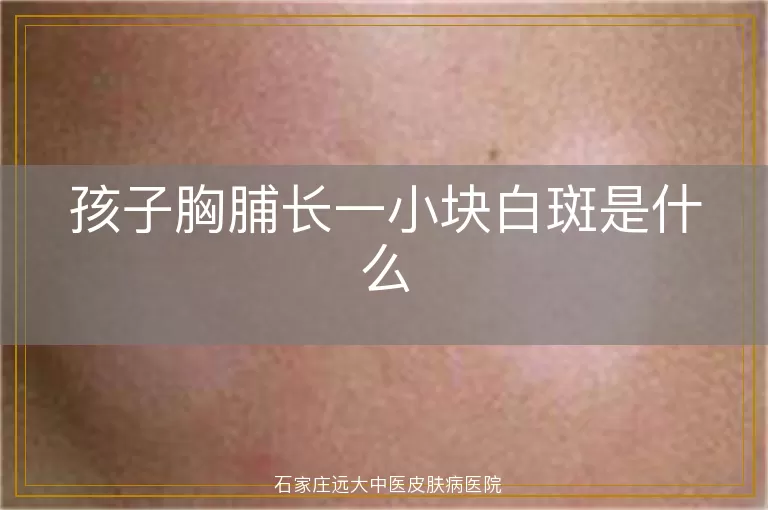 孩子胸脯长一小块白斑是什么