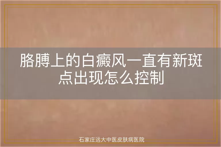 胳膊上的白癜风一直有新斑点出现怎么控制