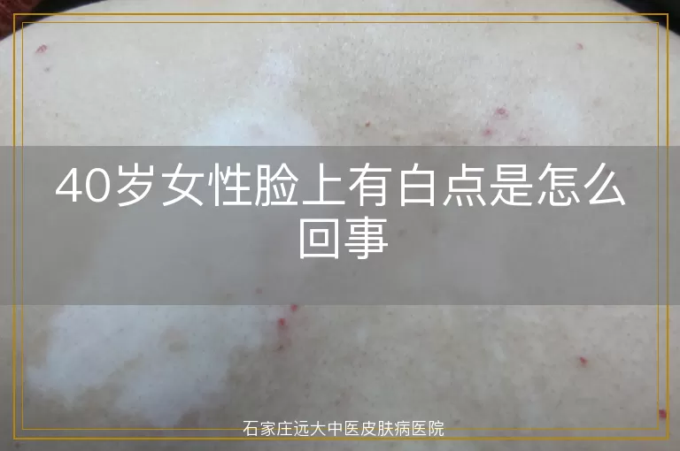 40岁女性脸上有白点是怎么回事