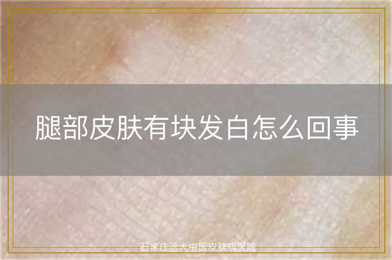 腿部皮肤有块发白怎么回事