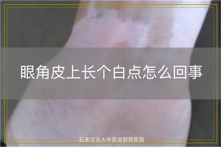 眼角皮上长个白点怎么回事