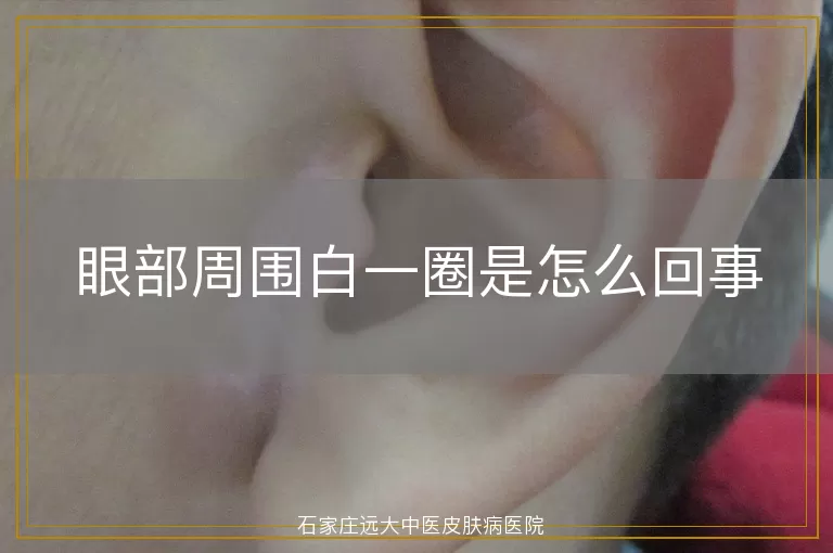 眼部周围白一圈是怎么回事