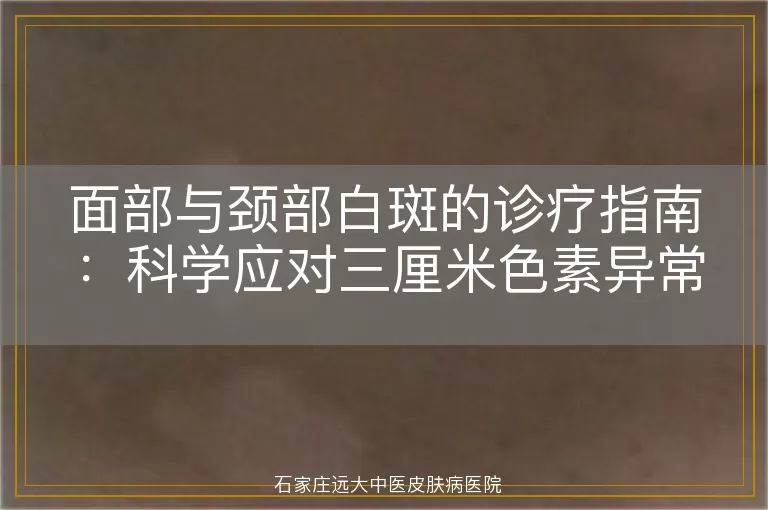 面部与颈部白斑的诊疗指南：科学应对三厘米色素异常问题