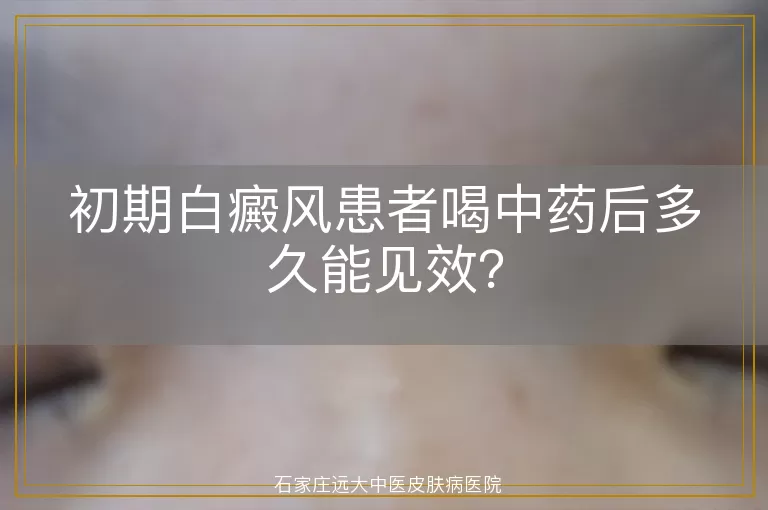 初期白癜风患者喝中药后多久能见效？