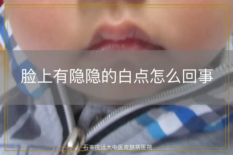 脸上有隐隐的白点怎么回事