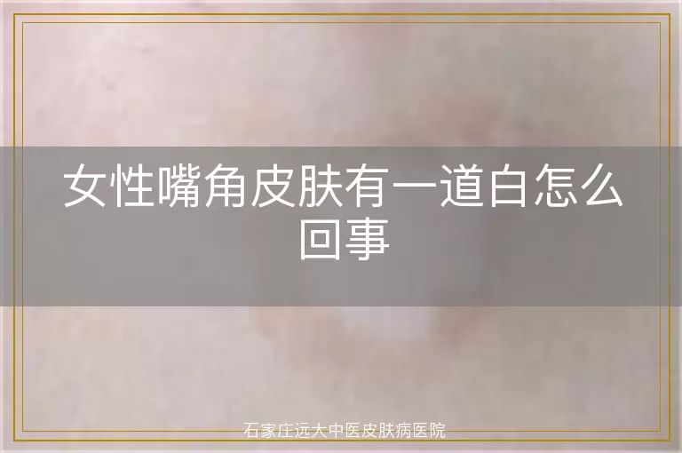 女性嘴角皮肤有一道白怎么回事