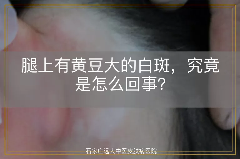 腿上有黄豆大的白斑，究竟是怎么回事？