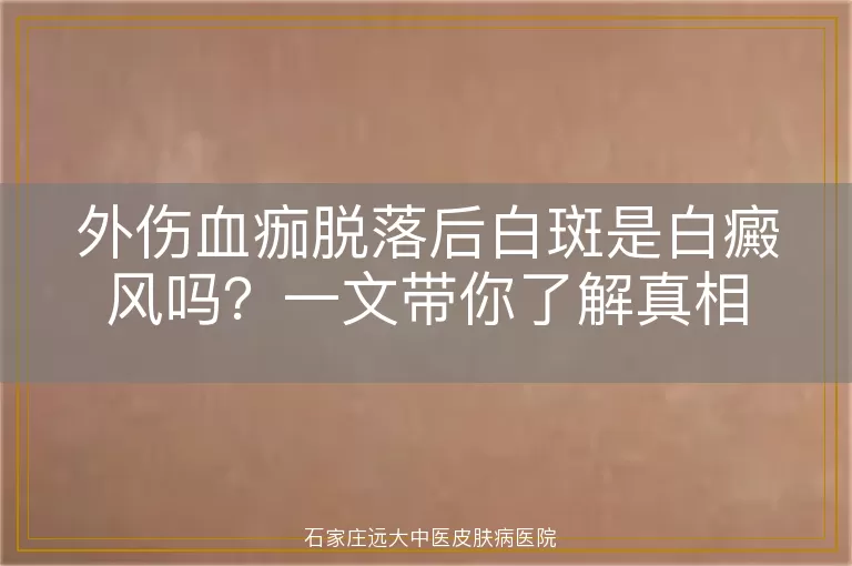 外伤血痂脱落后白斑是白癜风吗？一文带你了解真相