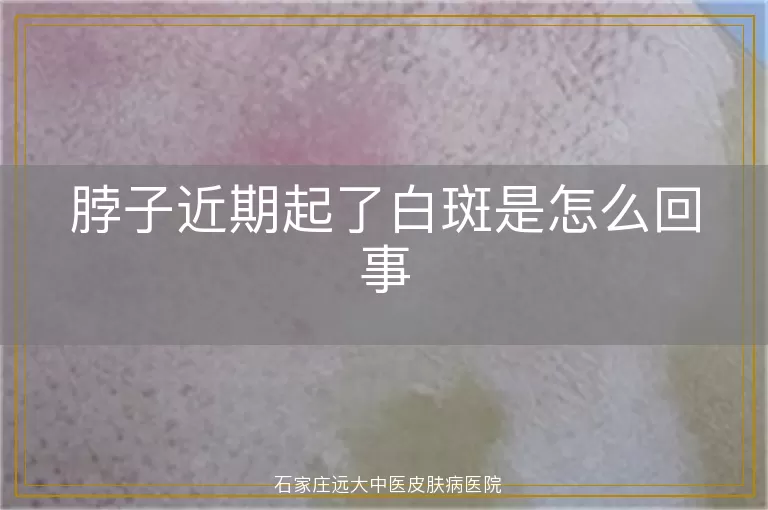 脖子近期起了白斑是怎么回事