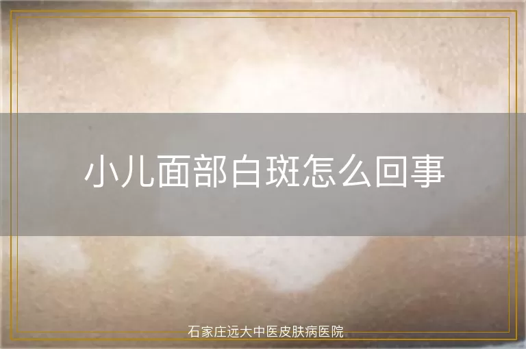小儿面部白斑怎么回事
