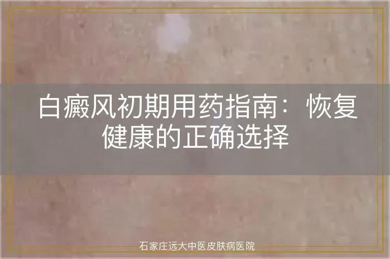 白癜风初期用药指南：恢复健康的正确选择