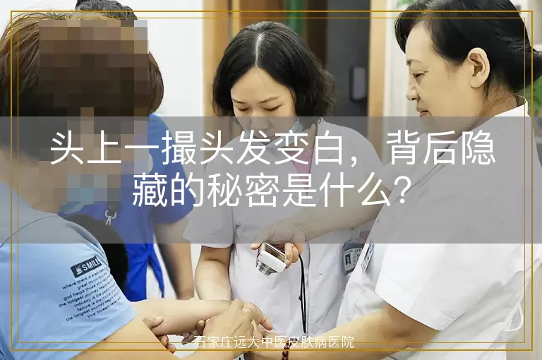 头上一撮头发变白，背后隐藏的秘密是什么？