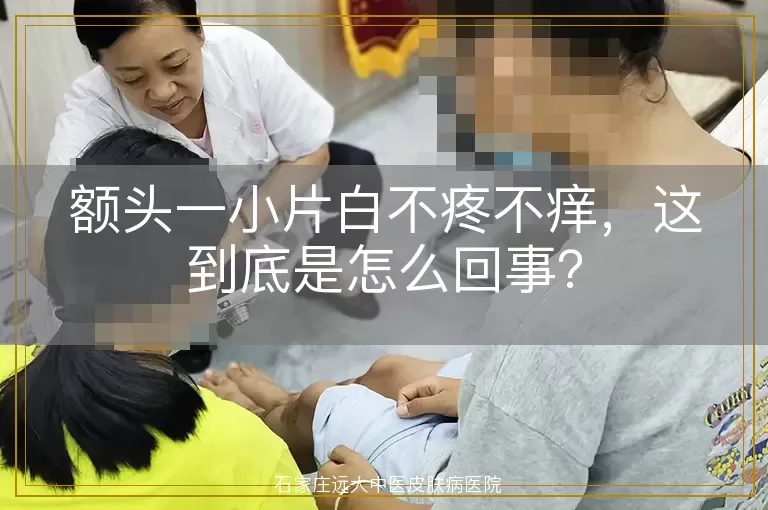 额头一小片白不疼不痒，这到底是怎么回事？