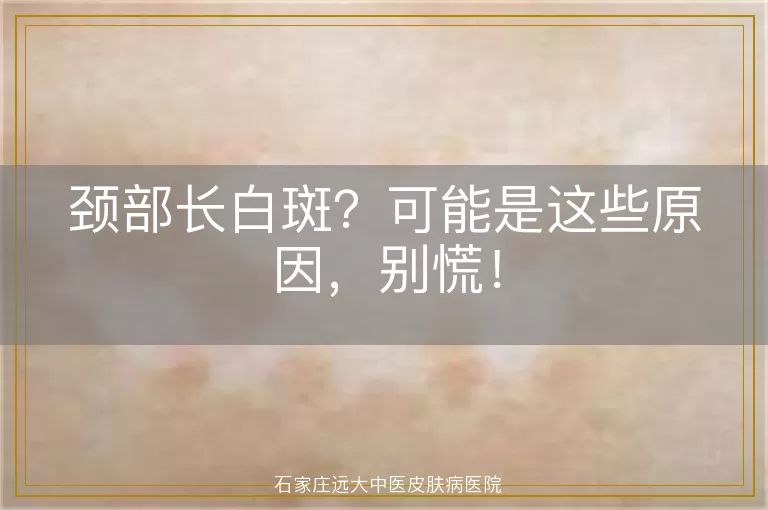 颈部长白斑?可能是这些原因,别慌!