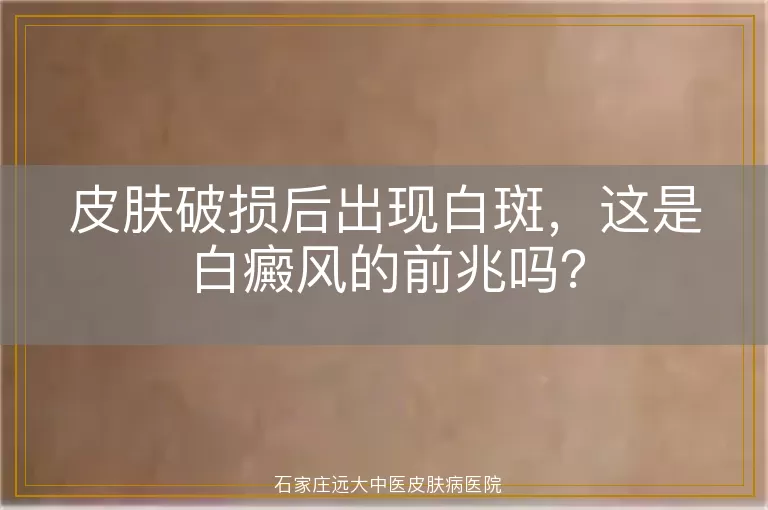 皮肤破损后出现白斑，这是白癜风的前兆吗？