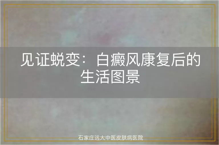 见证蜕变：白癜风康复后的生活图景
