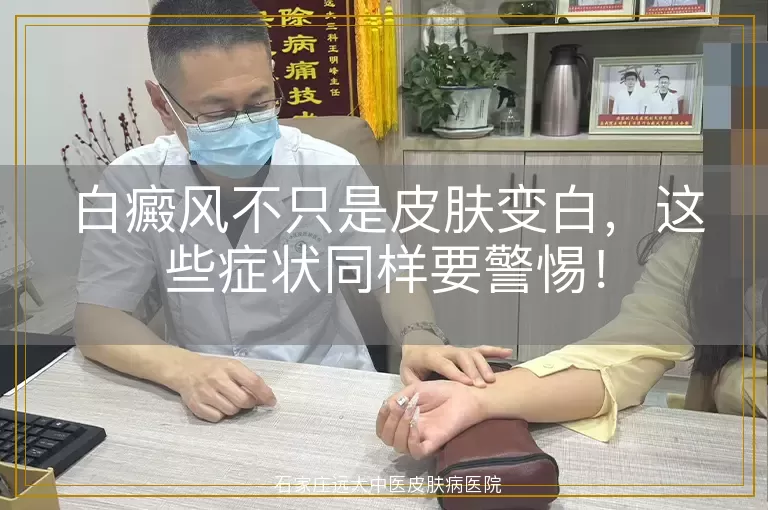 白癜风不只是皮肤变白，这些症状同样要警惕！
