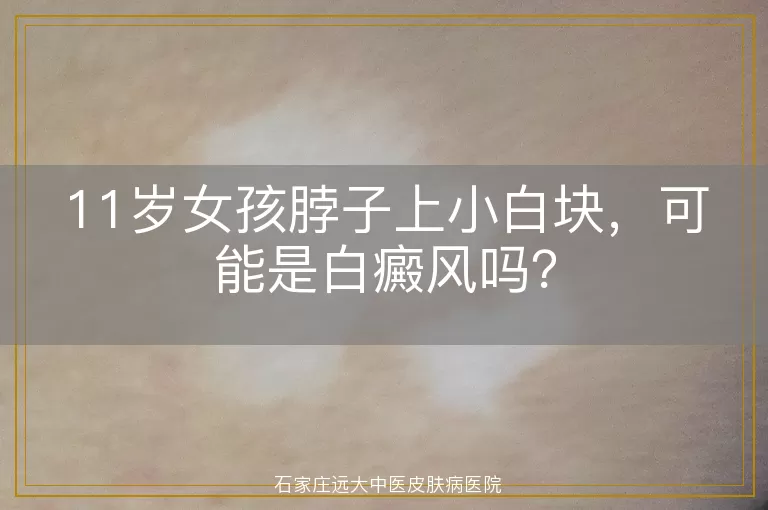 11岁女孩脖子上小白块，可能是白癜风吗？