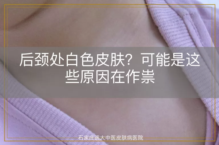 后颈处白色皮肤?可能是这些原因在作祟