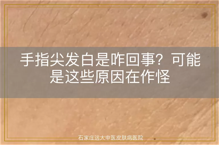 手指尖发白是咋回事？可能是这些原因在作怪