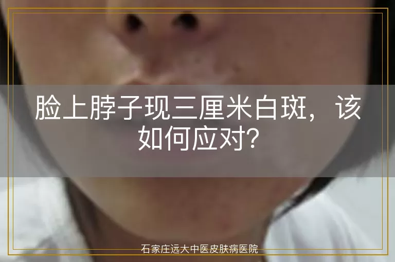 脸上脖子现三厘米白斑，该如何应对？