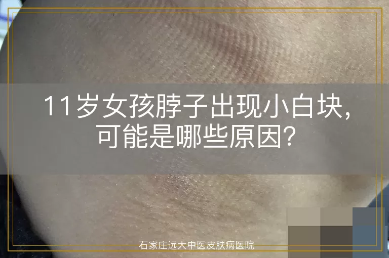 11岁女孩脖子出现小白块，可能是哪些原因？