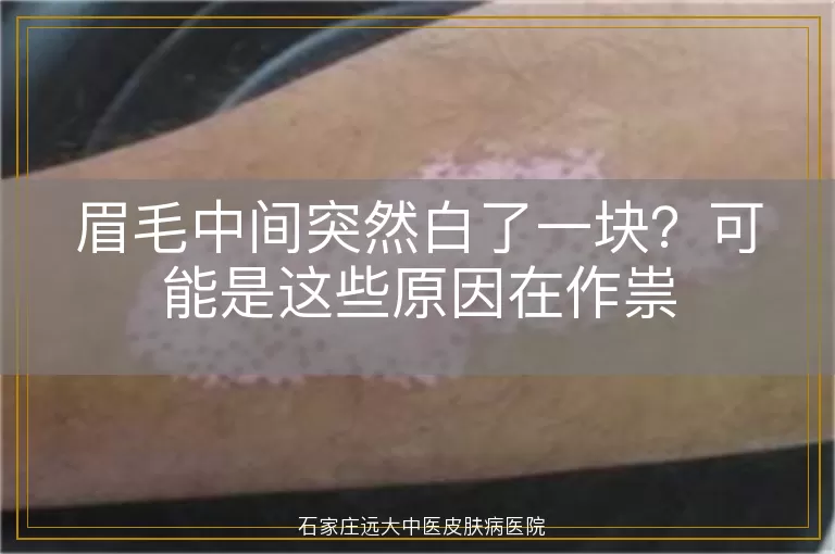 眉毛中间突然白了一块？可能是这些原因在作祟