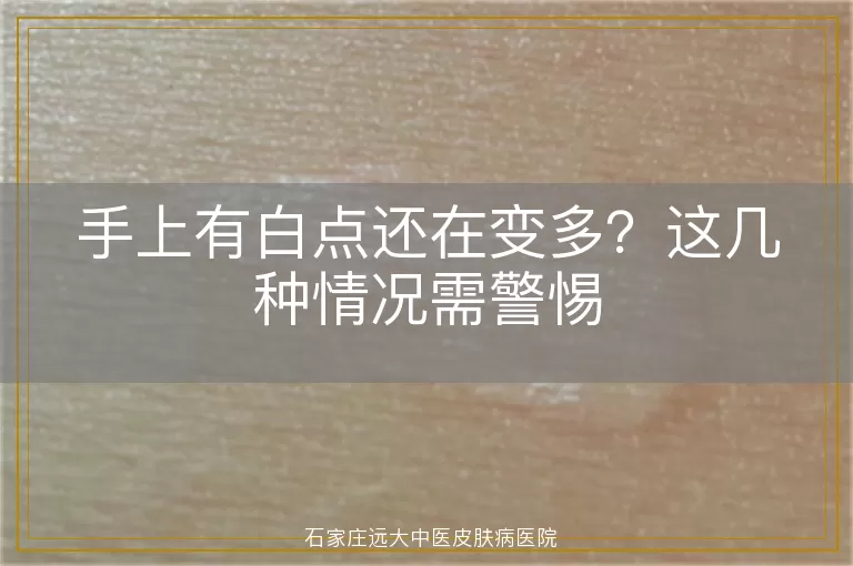 手上有白点还在变多？这几种情况需警惕