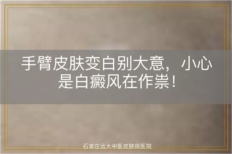 手臂皮肤变白别大意，小心是白癜风在作祟！