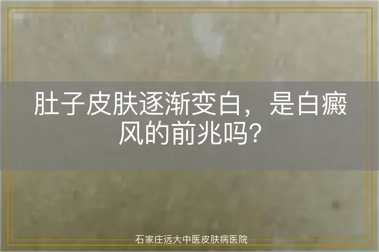 肚子皮肤逐渐变白，是白癜风的前兆吗？