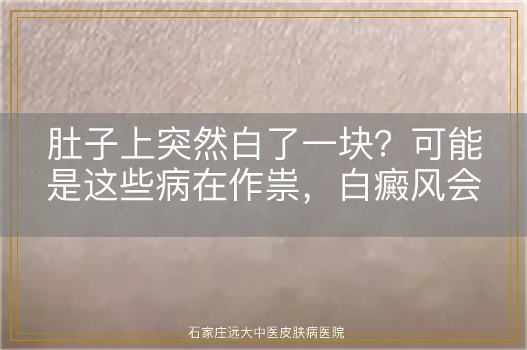 肚子上突然白了一块?可能是这些病在作祟,白癜风会中招吗?