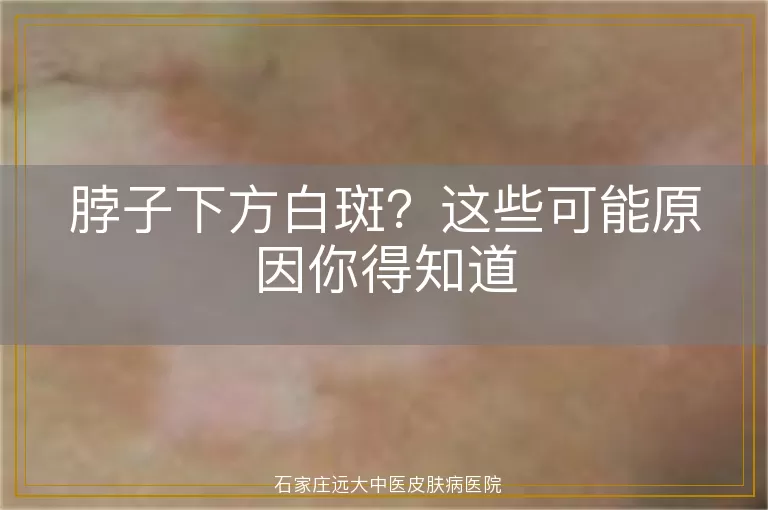 脖子下方白斑？这些可能原因你得知道