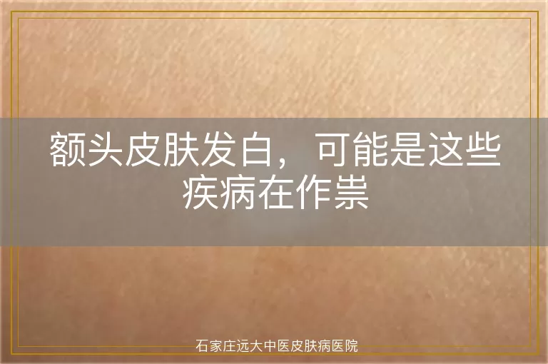 额头皮肤发白，可能是这些疾病在作祟