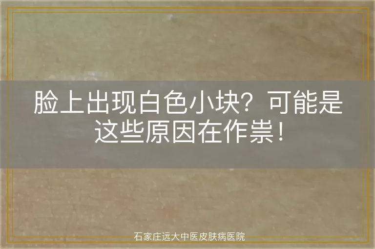 脸上出现白色小块?可能是这些原因在作祟!