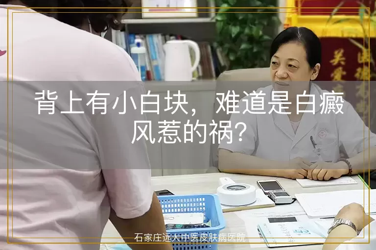 背上有小白块，难道是白癜风惹的祸？