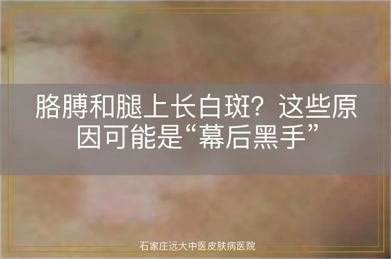 胳膊和腿上长白斑？这些原因可能是“幕后黑手”