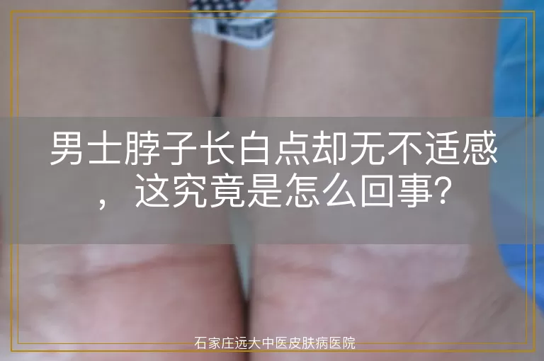 男士脖子长白点却无不适感，这究竟是怎么回事？