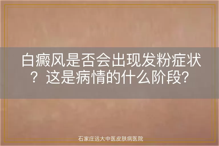 白癜风是否会出现发粉症状？这是病情的什么阶段？