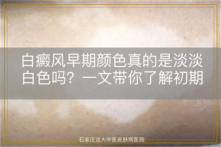 白癜风早期颜色真的是淡淡白色吗？一文带你了解初期症状