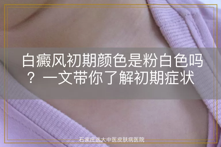 白癜风初期颜色是粉白色吗？一文带你了解初期症状