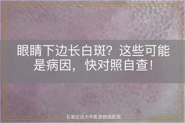 眼睛下边长白斑？这些可能是病因，快对照自查！