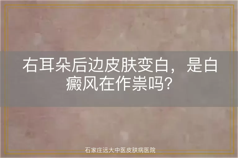 右耳朵后边皮肤变白，是白癜风在作祟吗？