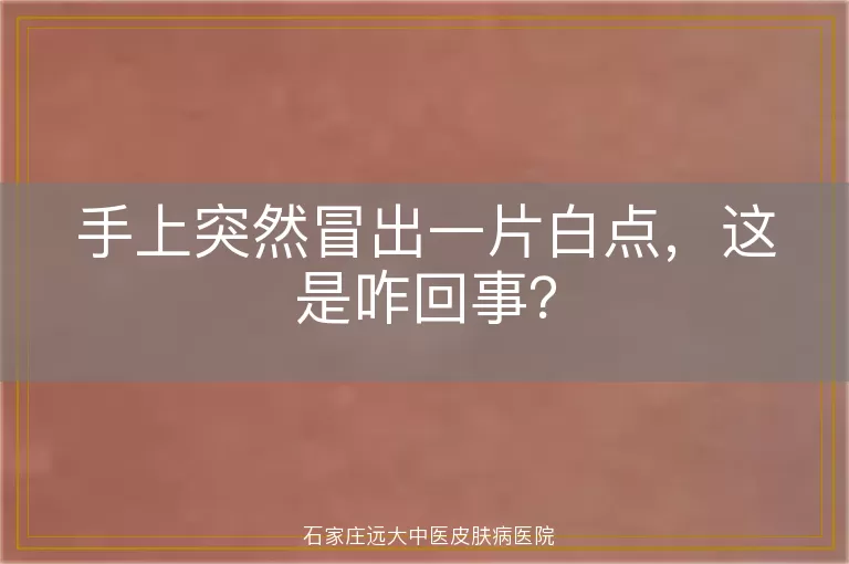 手上突然冒出一片白点，这是咋回事？